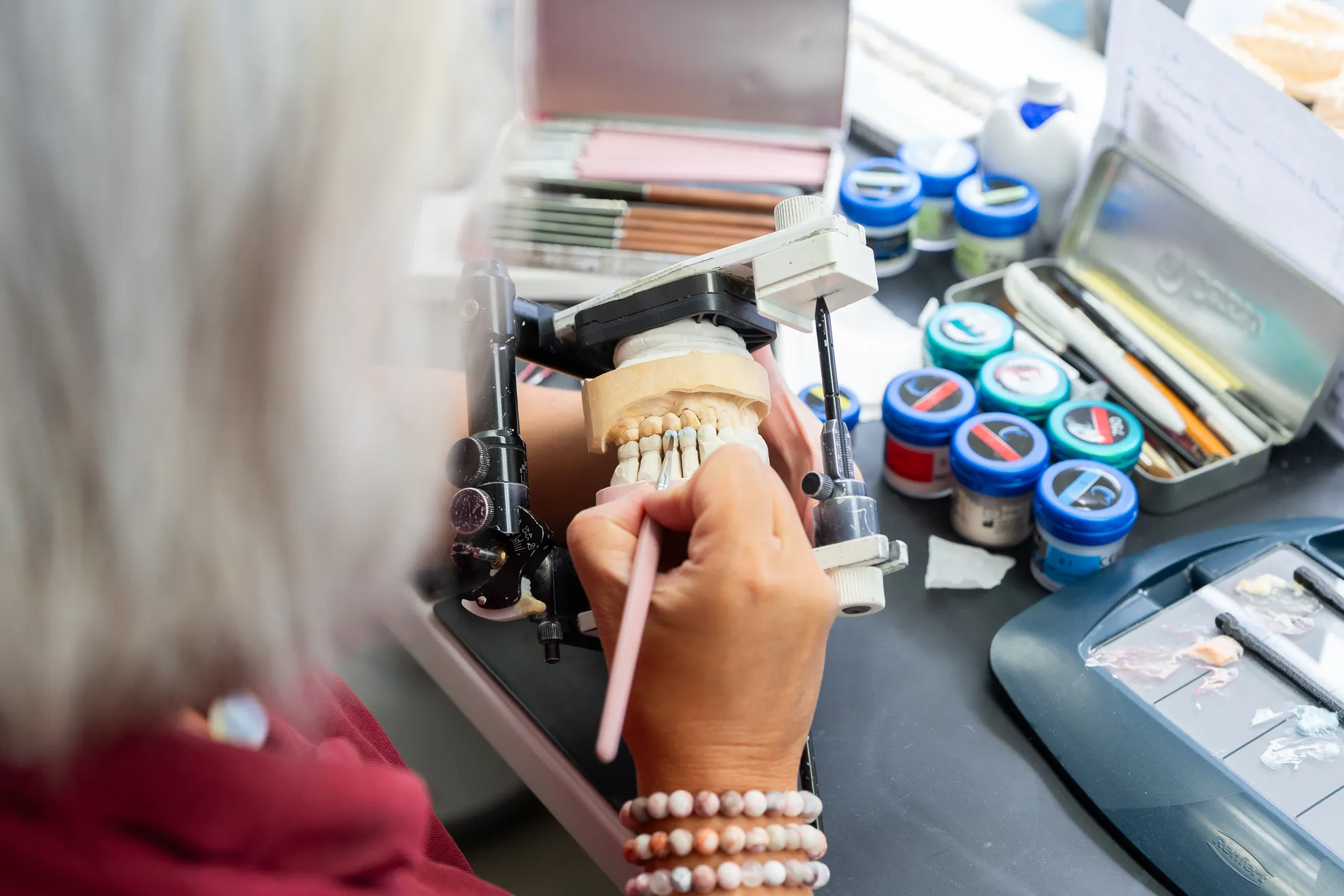 Gebiss wird mit einer Masse bestrichen