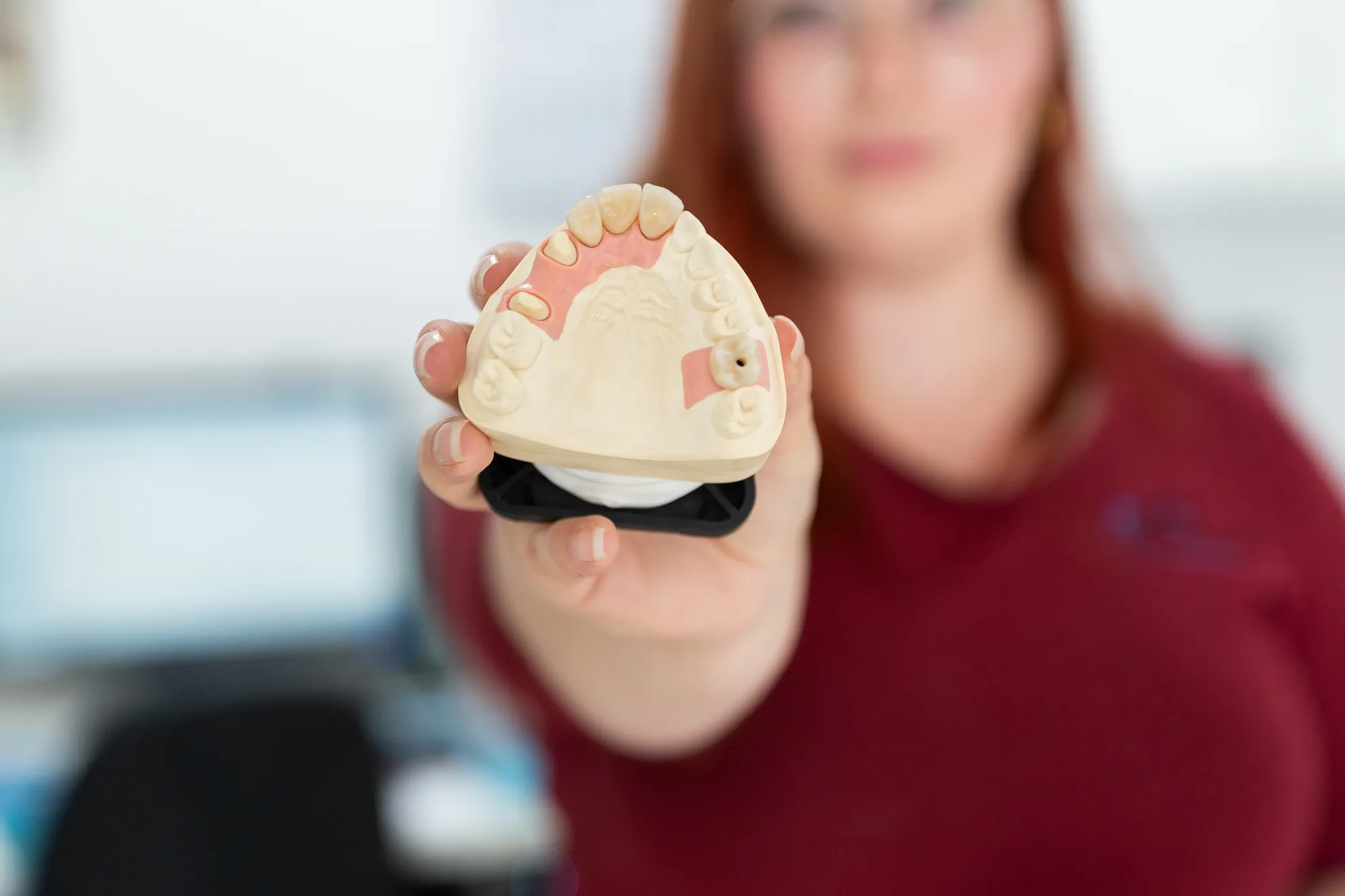 Frau (unscharf im Hintergrund) streckt ein fertigen Gebissabdruck in die Kamera